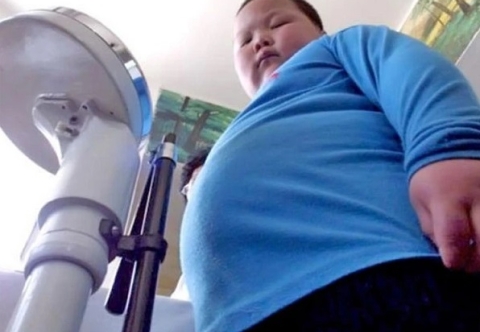 Tổng quan về béo phì trẻ em